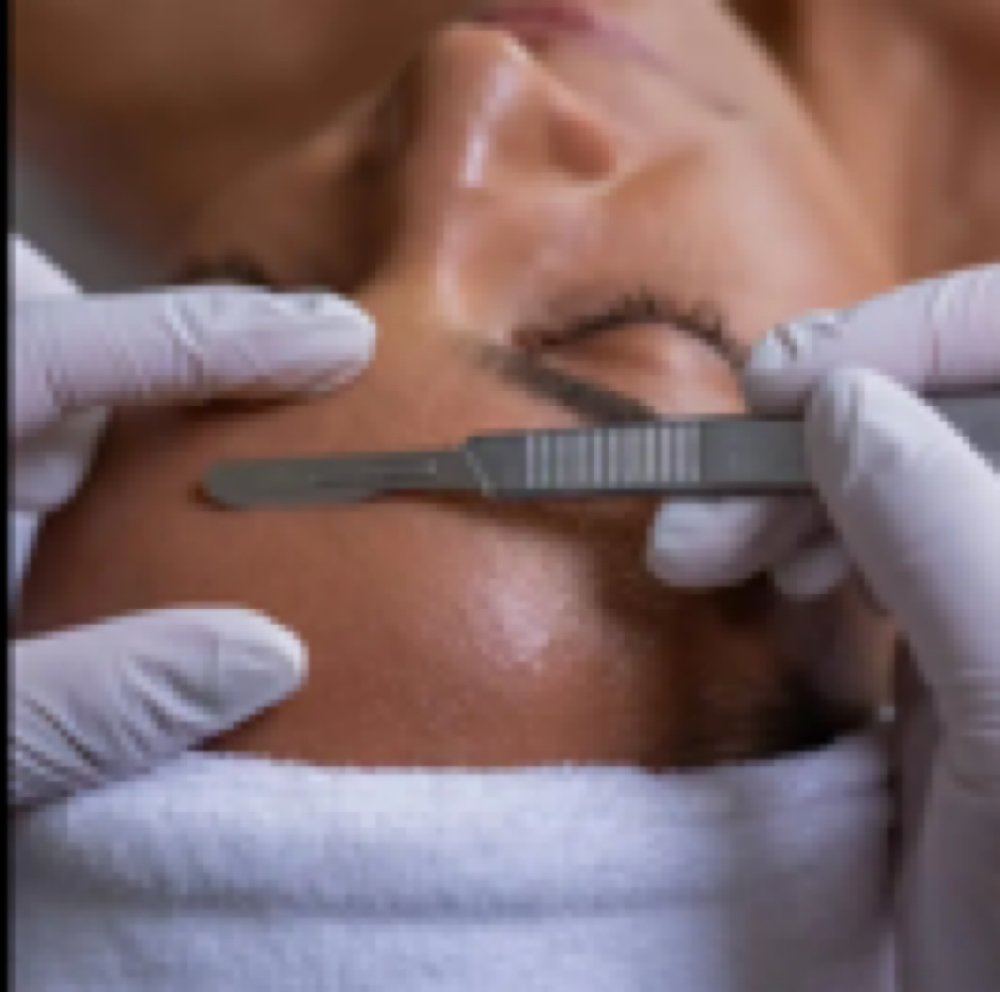 Dermaplaning at The Layer & The Spell by Rexstyles in Point Pleasant Beach, NJ