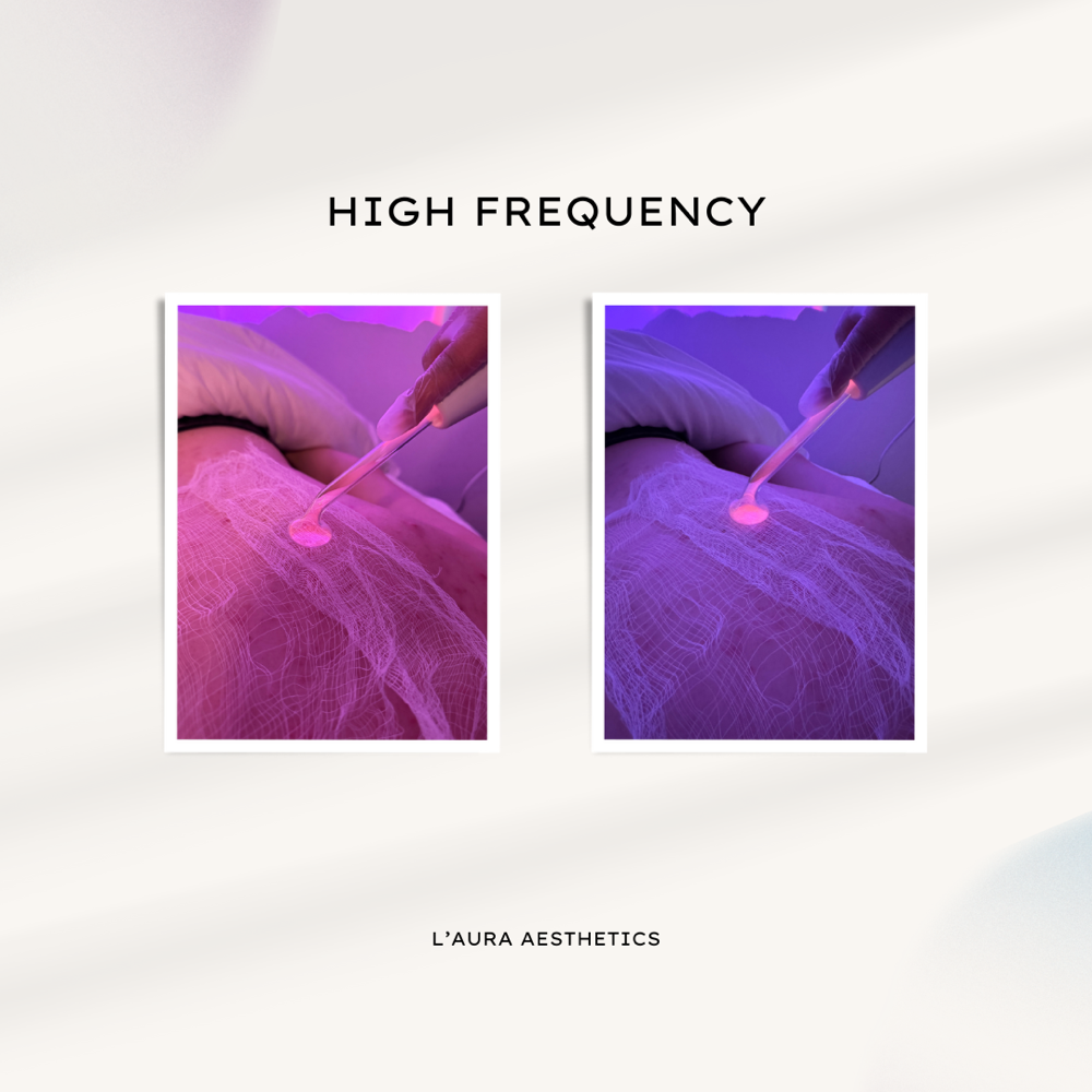 High Frequency