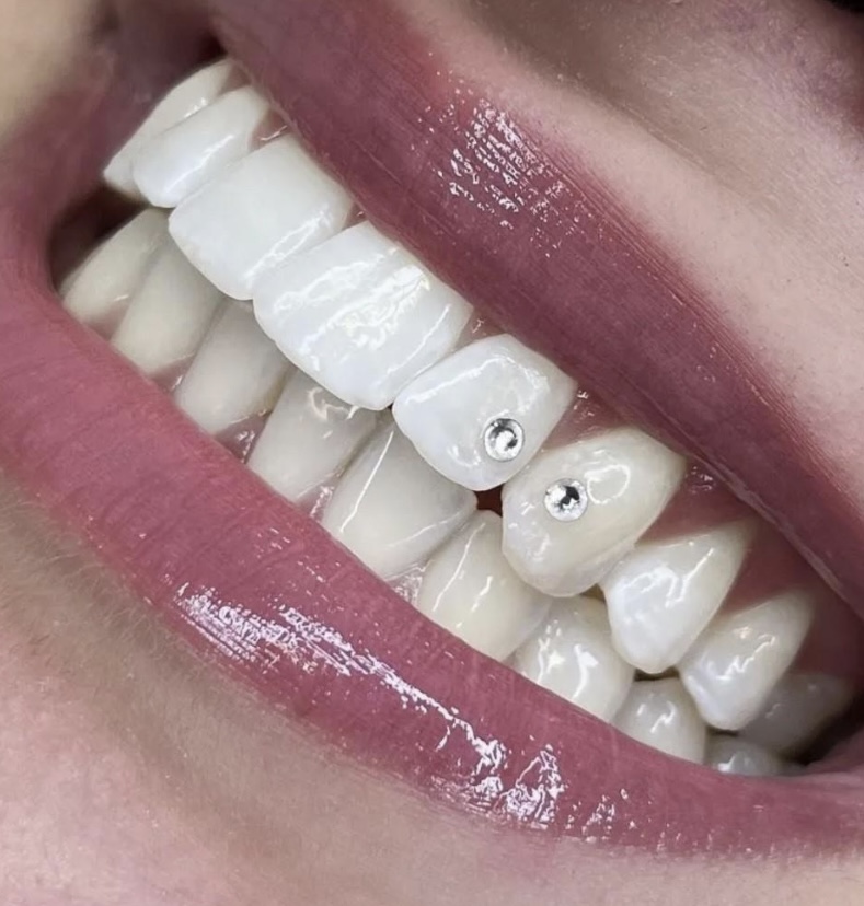 Tooth Gem