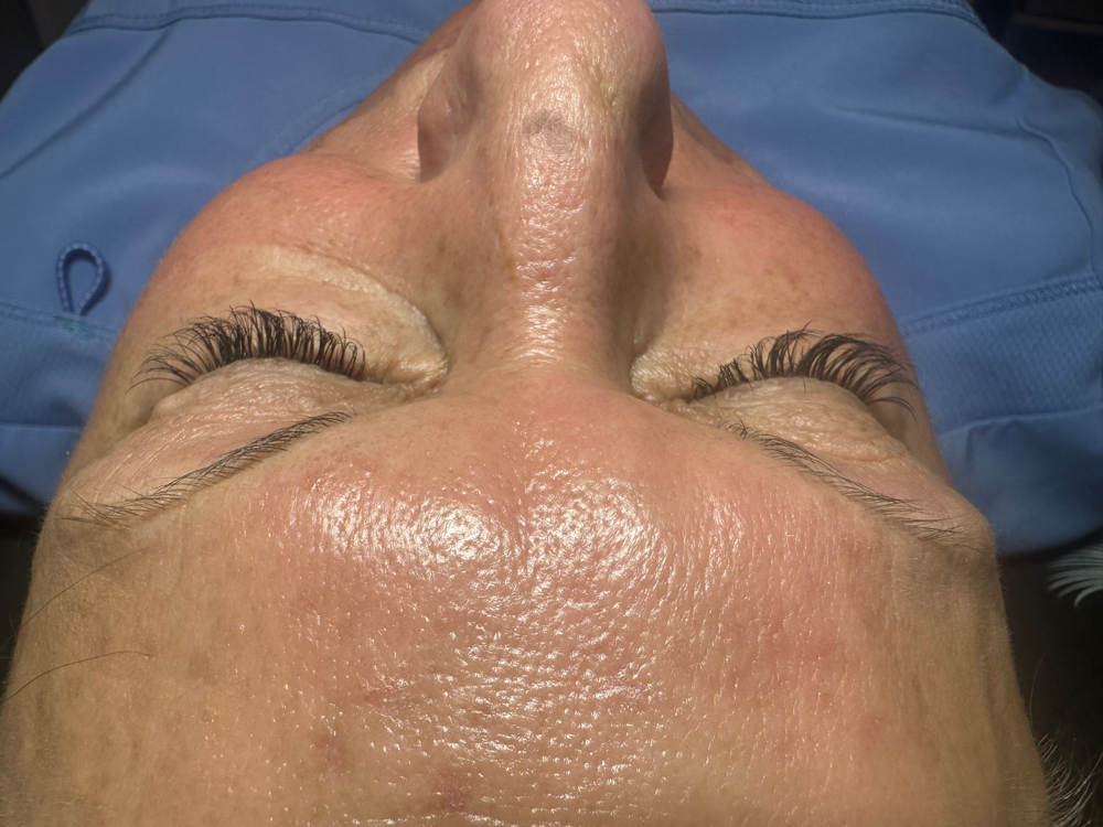 Hybrid Lash Extensions