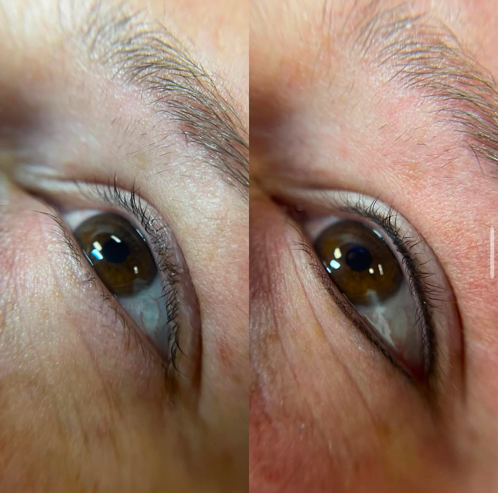 Lash Line Enhancement