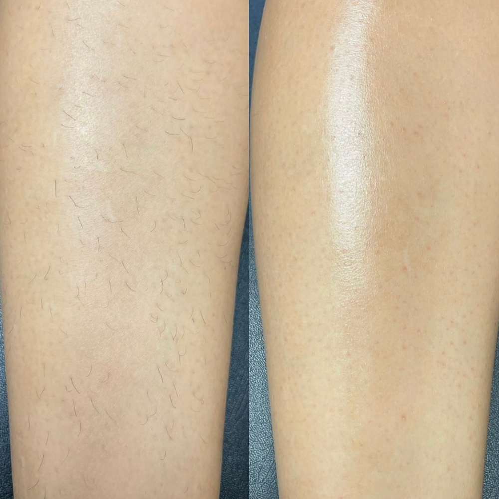 Half Leg Wax