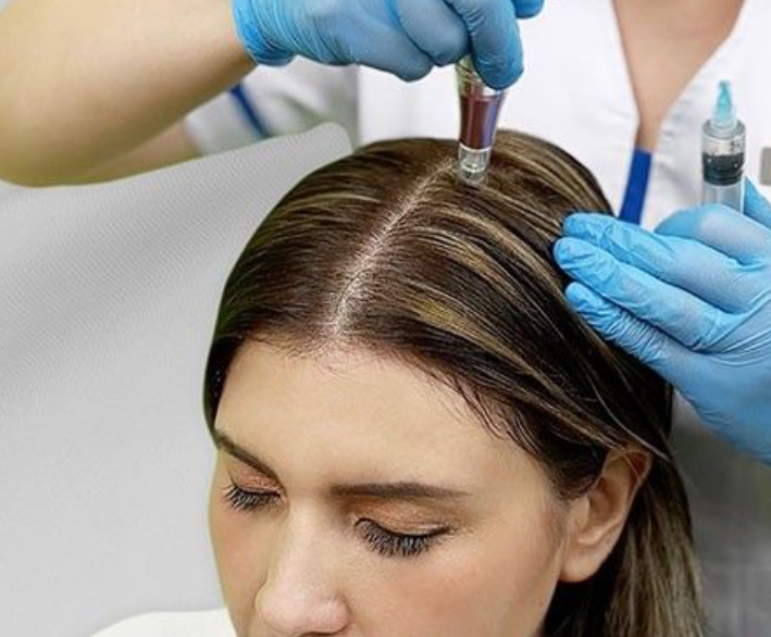 Bio Hair Growth Therapy