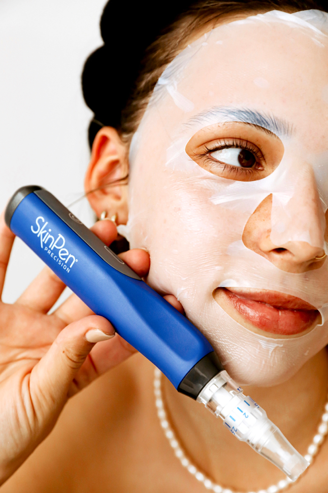 SkinPen Microneedling