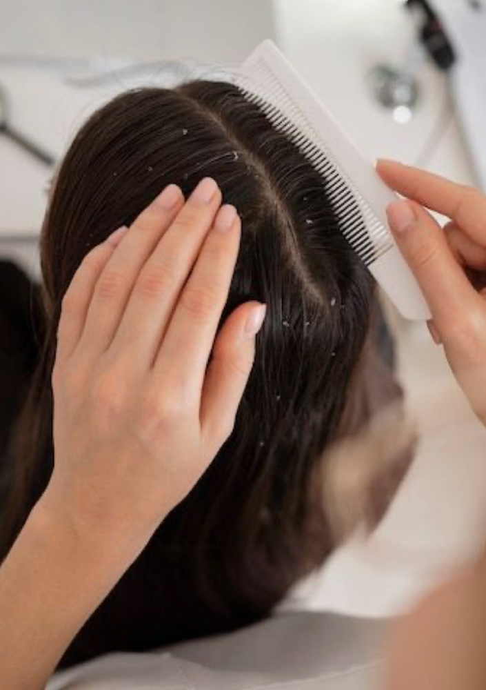 Scalp Treatment