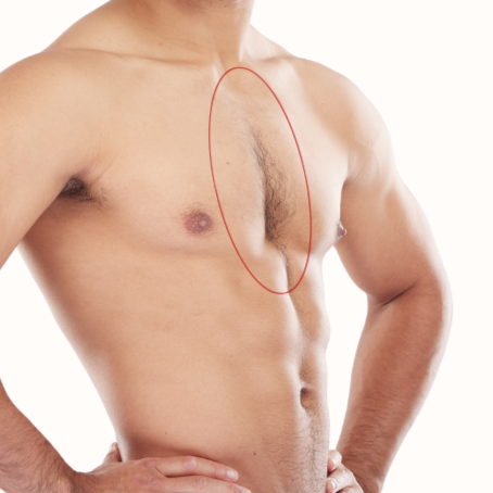 Chest Strip at Bareline Aesthetics in Brea, CA