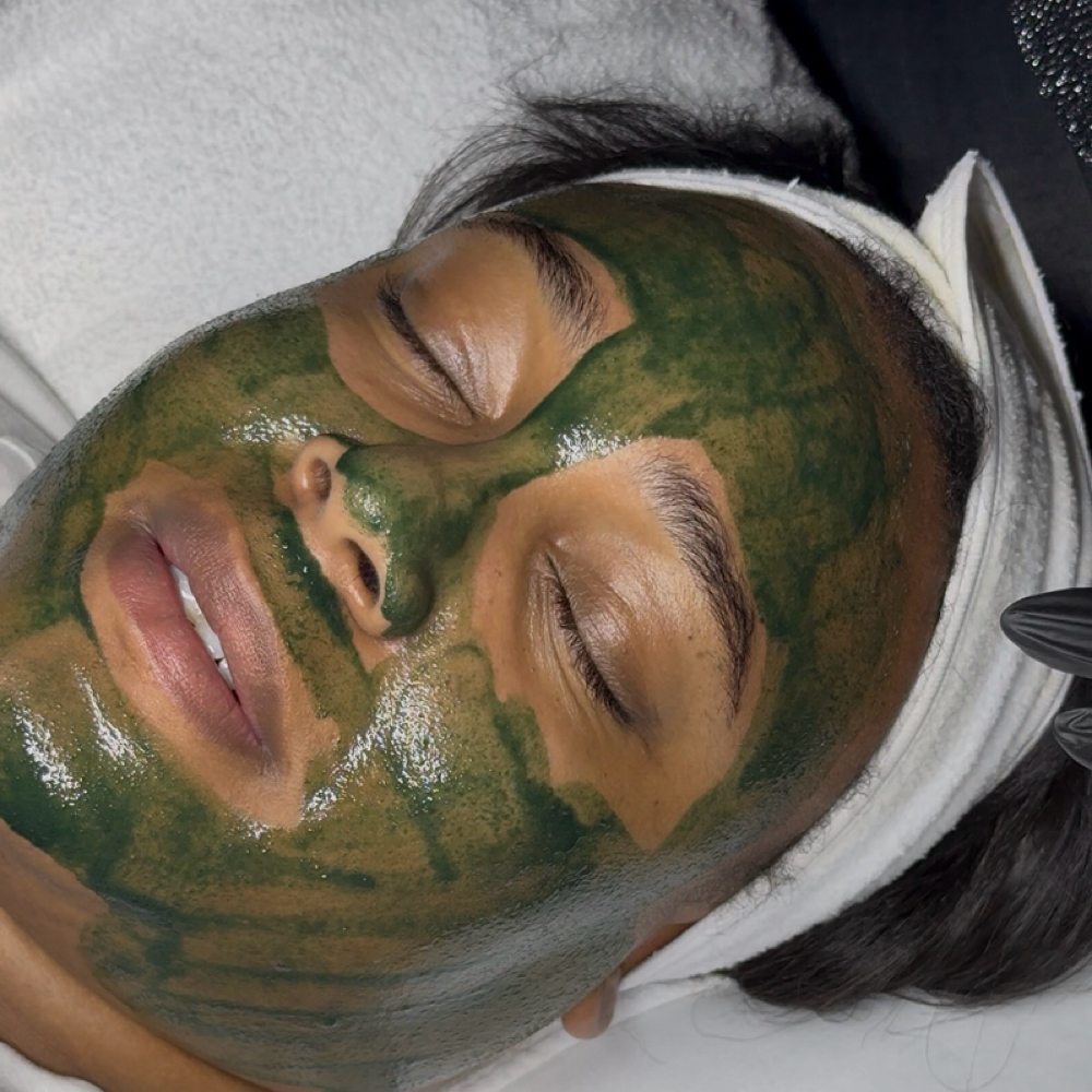 Level IV: Liquid Microneedling Peel at Lavish Love Aesthetics in Southlake, TX
