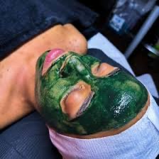 Level IV: Liquid Microneedling Peel