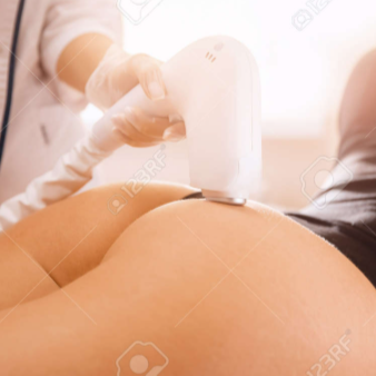 Gluteus Laser Hair Removal at The Beautee Spot in Phoenix, AZ