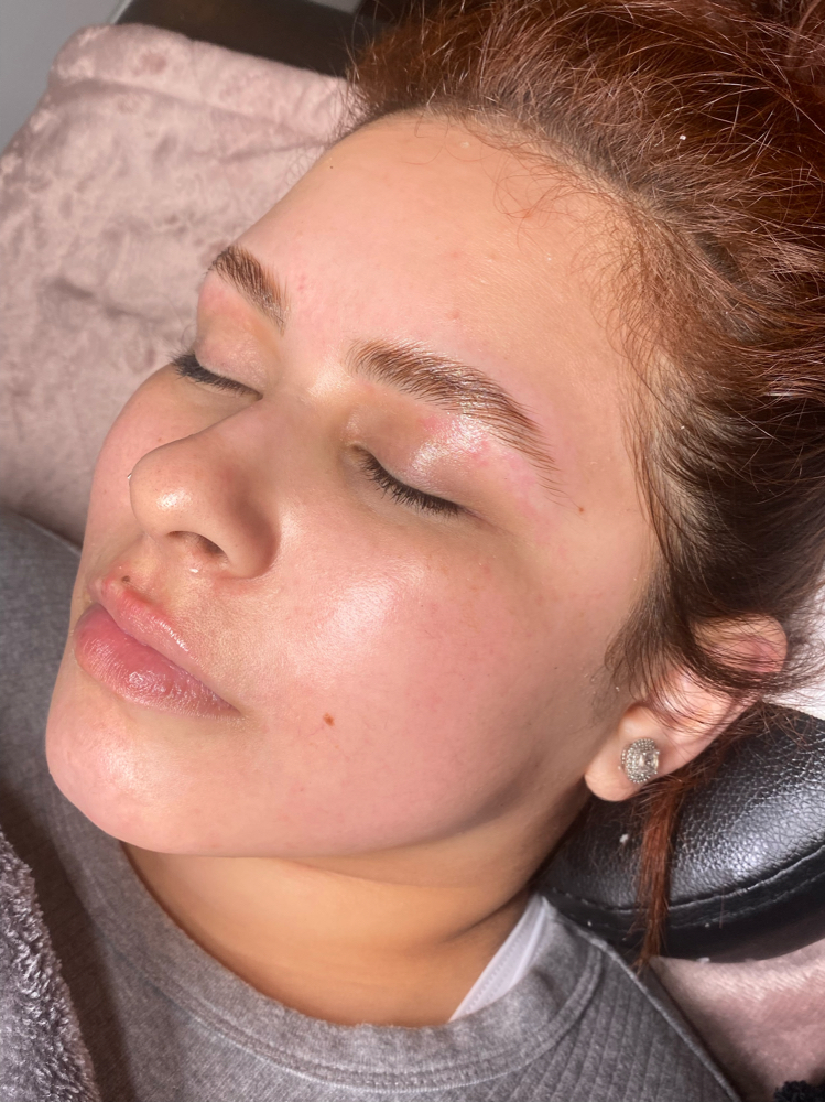 Dermaplane Facial