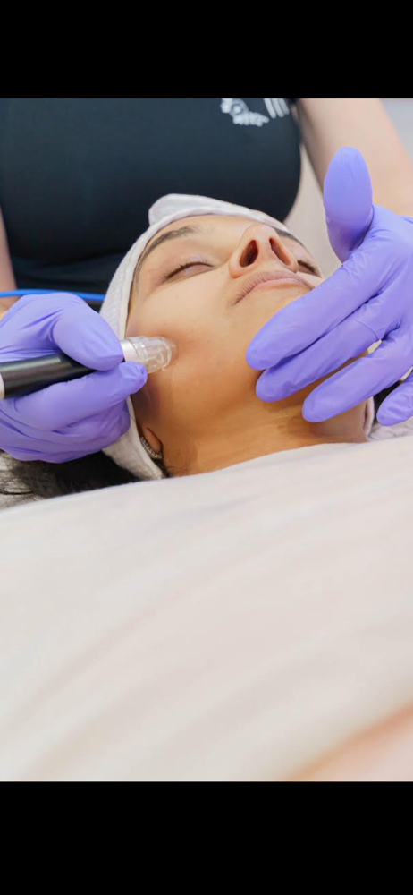 Hydro Facial