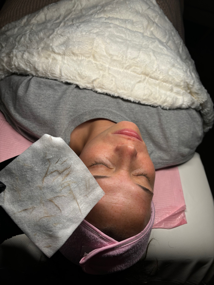 Dermaplane and Chemical Peel