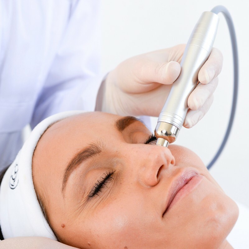 Diamond Microdermabrasion Facial