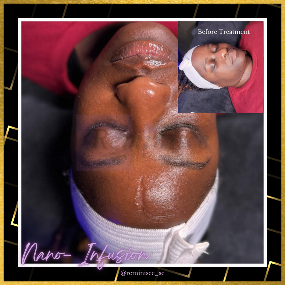 Nano-Infusion Facial (Hydrating)