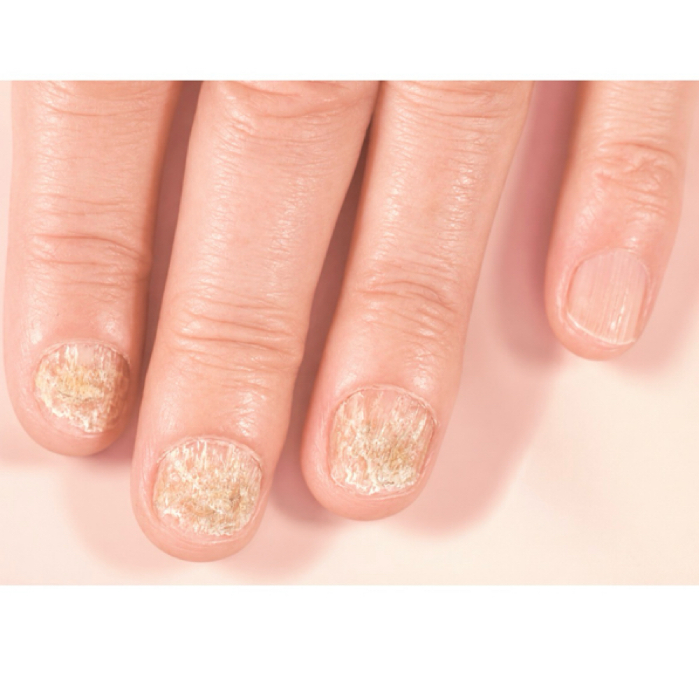 Nail Reconstruction (hands) at Apology in Oak Park, IL