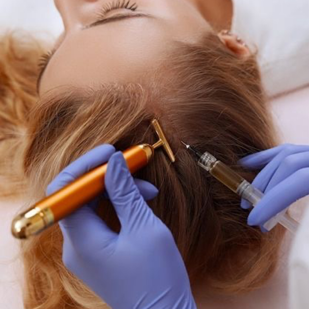 Hair PRP at SKN aesthetics in Elmhurst, IL