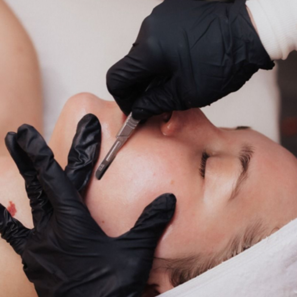 Dermaplaning Add-on at Beauty Building in Webster, NY