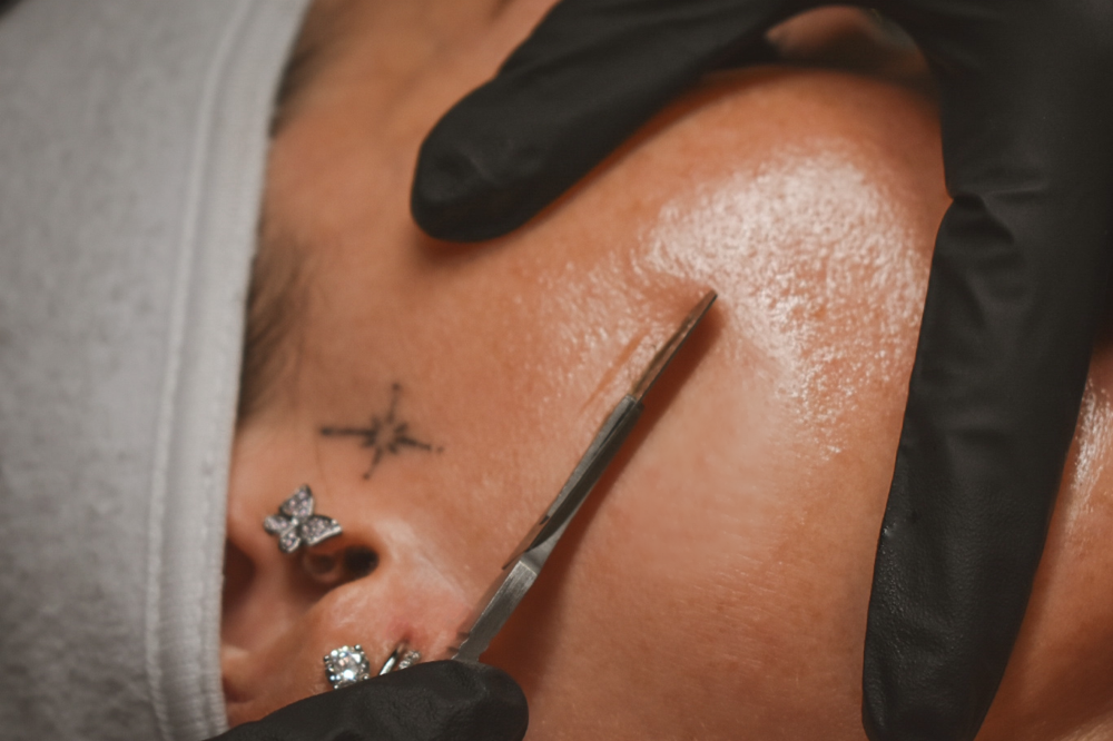 DERMAPLANE ONLY