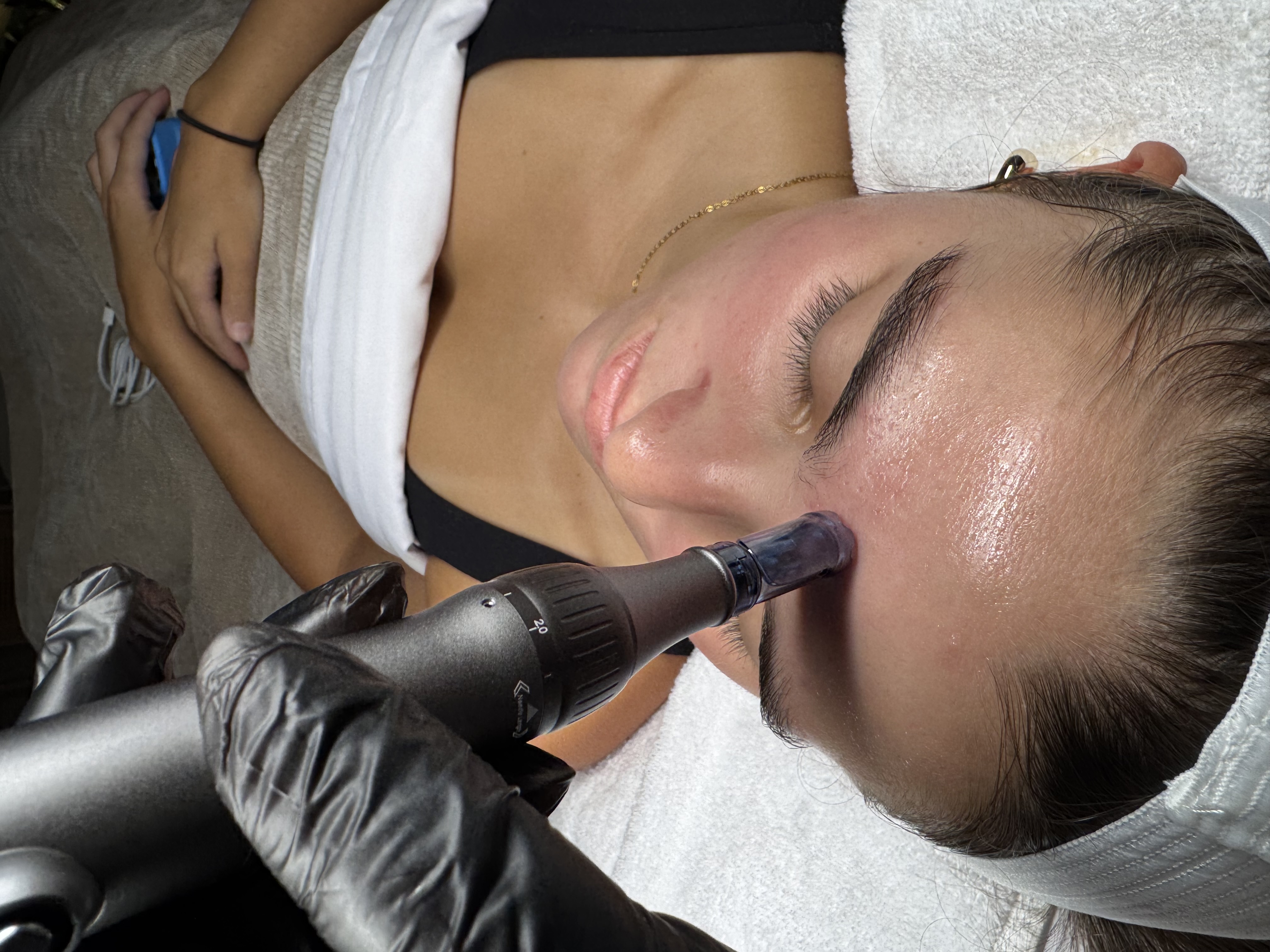 Nano Infusion (ADD ON)