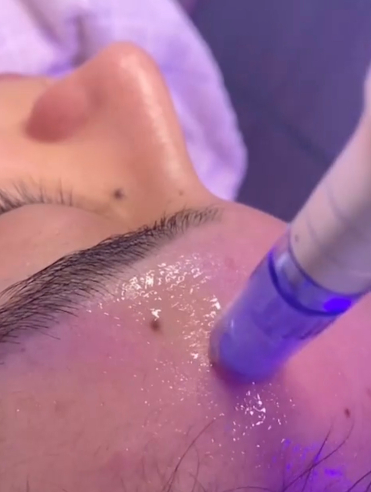 Nano Facial