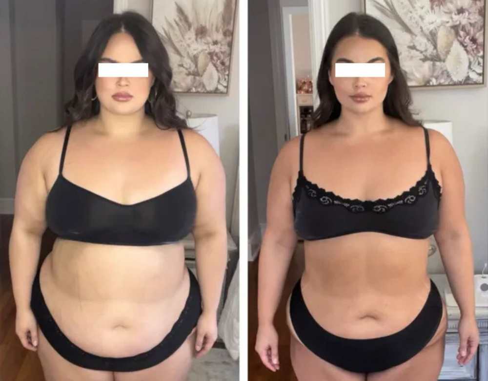 GLP1’s/Peptides Consultation at Signature Skin Spa in Scottsdale, AZ