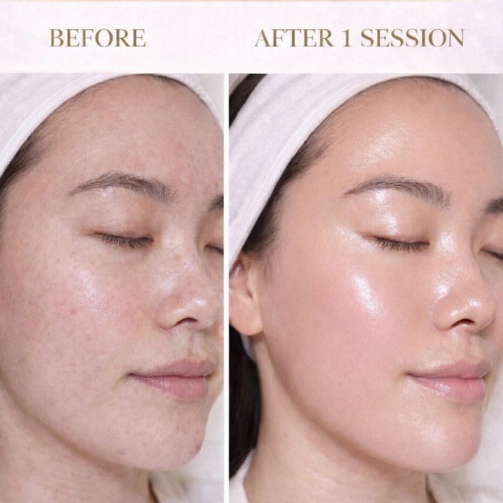 The $75 OFF Glass Skin Combo🪞✨ at Brow And Glow by Kathy in Bellflower, CA