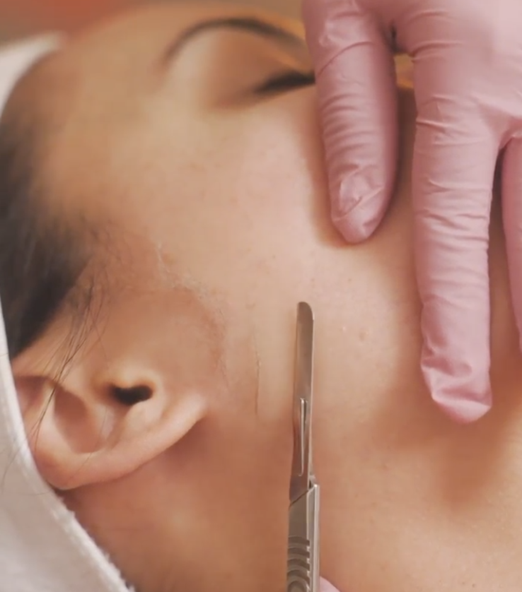 Dermaplane