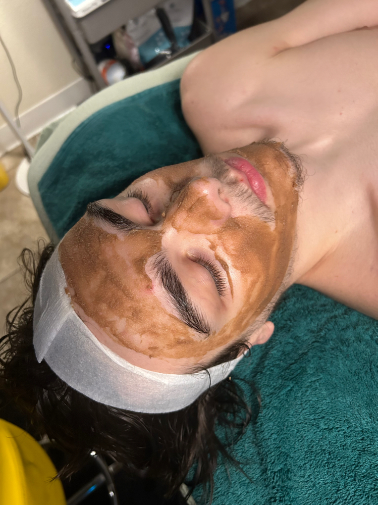 Teen Facial
