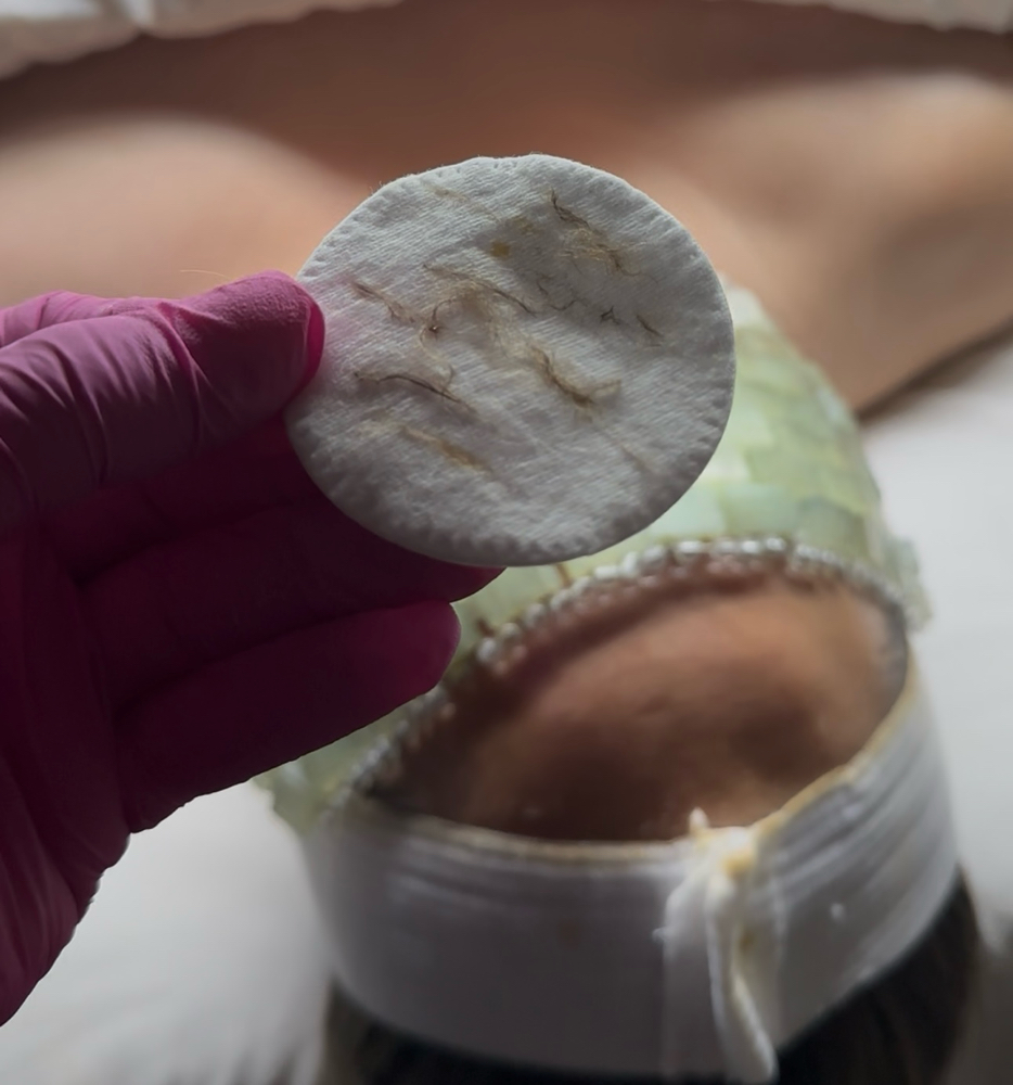 Express Dermaplaning Facial