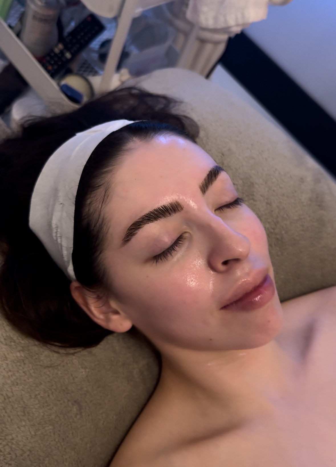 Microneedling x Hydrafacial x3