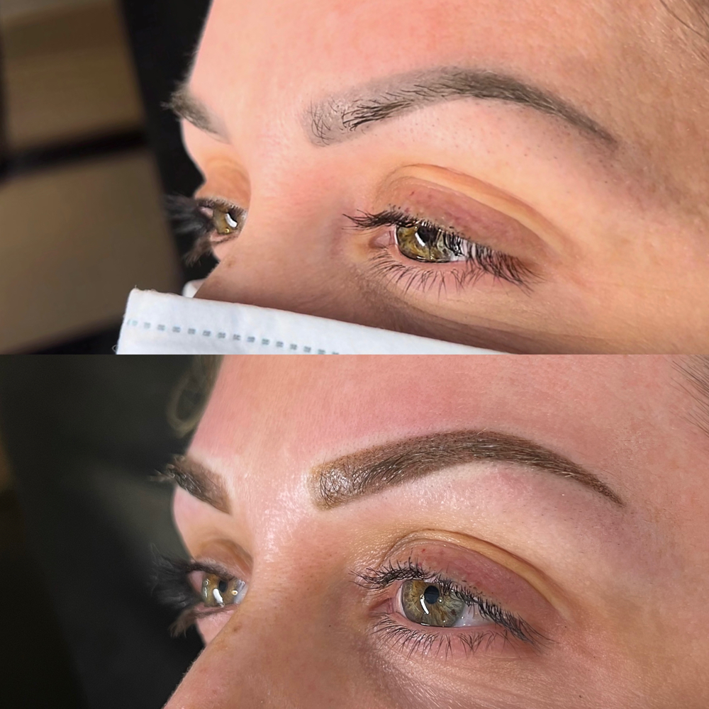 Brow Coverup/Correction