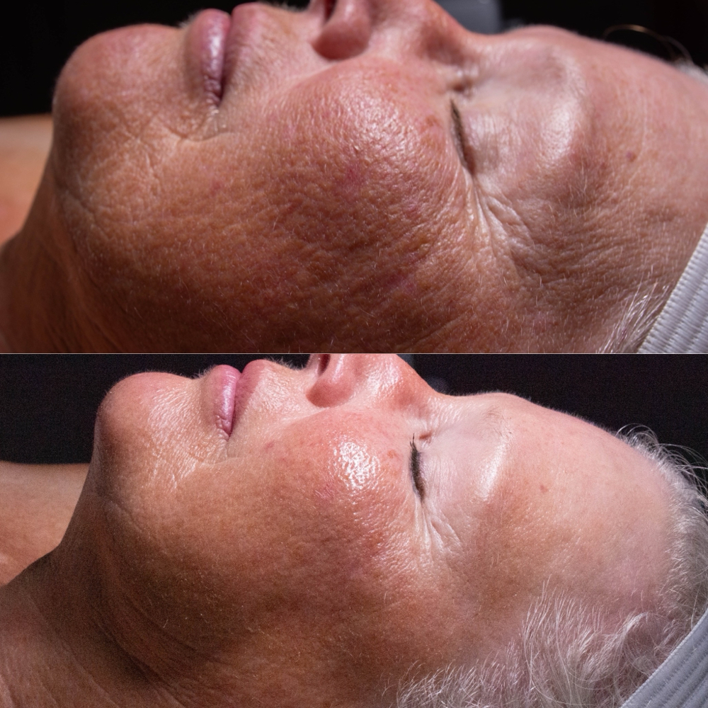 The Advanced Jet Renewal