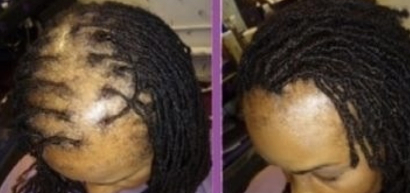 Loc Repair / Reattachment With Hair
