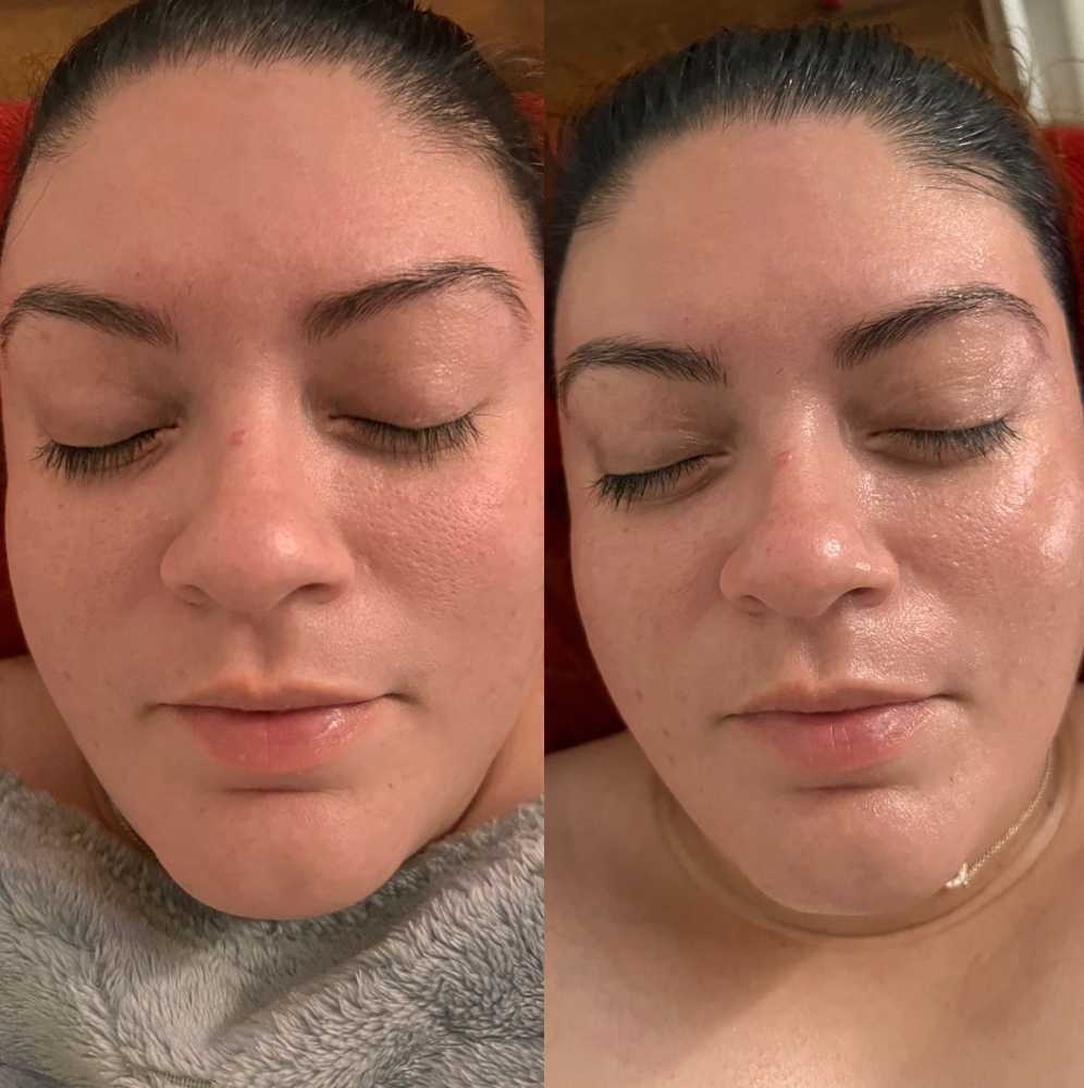 Beaux Express Facial at Beauxfemmesesthetics in Conroe, TX