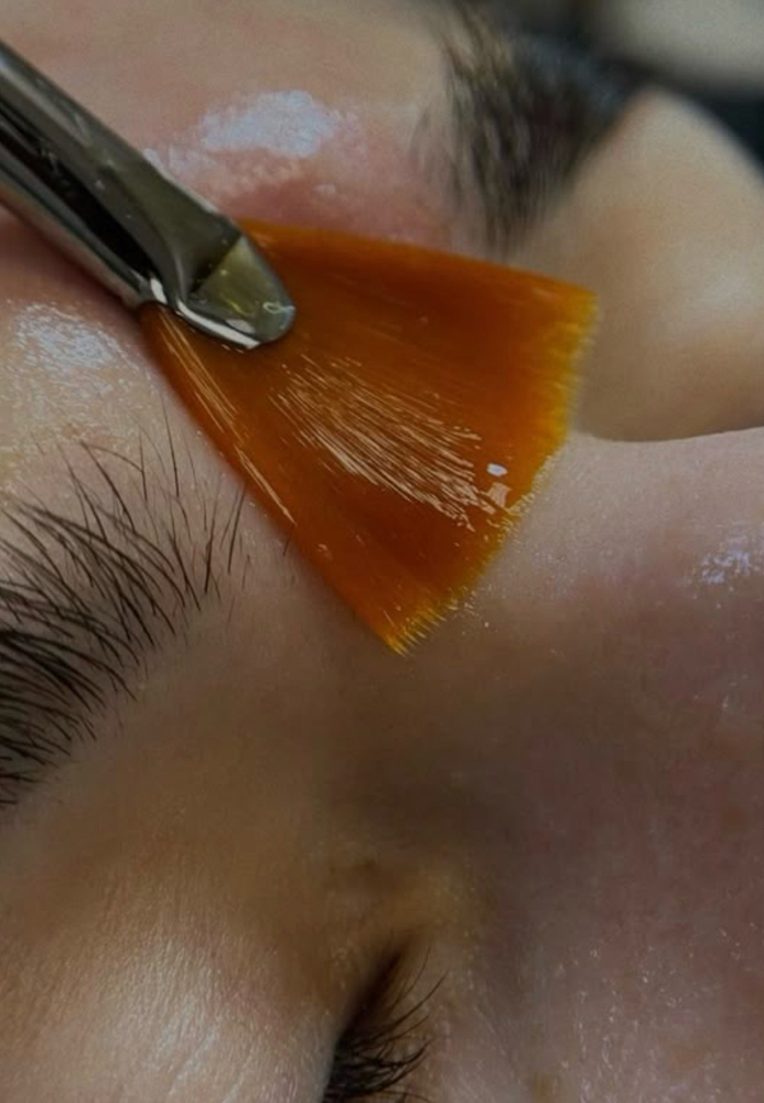 Chemical Peel at Skin by Dylan LLC in Atoka, TN