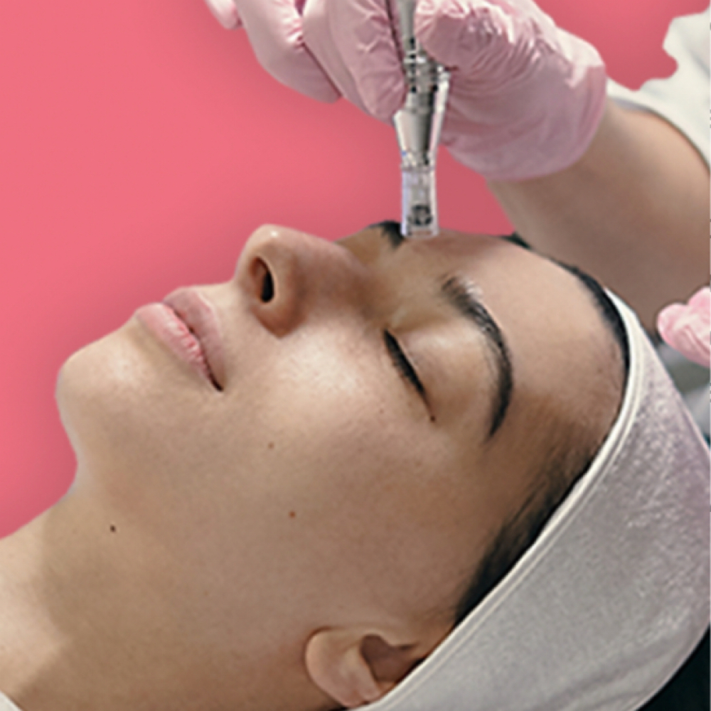 Nano Facial (Tox/PDRN/EGF)