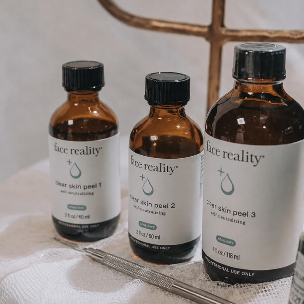 Acne Consult + Treatment at Salt + Light Skincare in Atascocita, TX