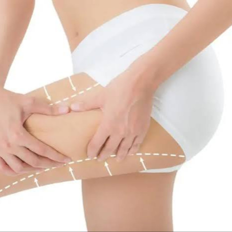 Inner/Outer Thighs at Kerala Ayurveda Panchakarma Center LLC in brandon, FL