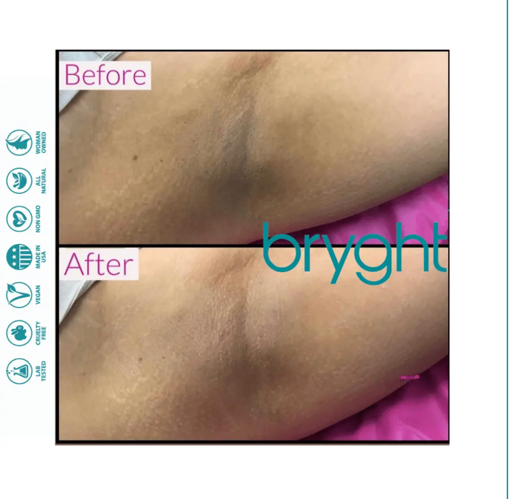 Bum Bryght Treatment