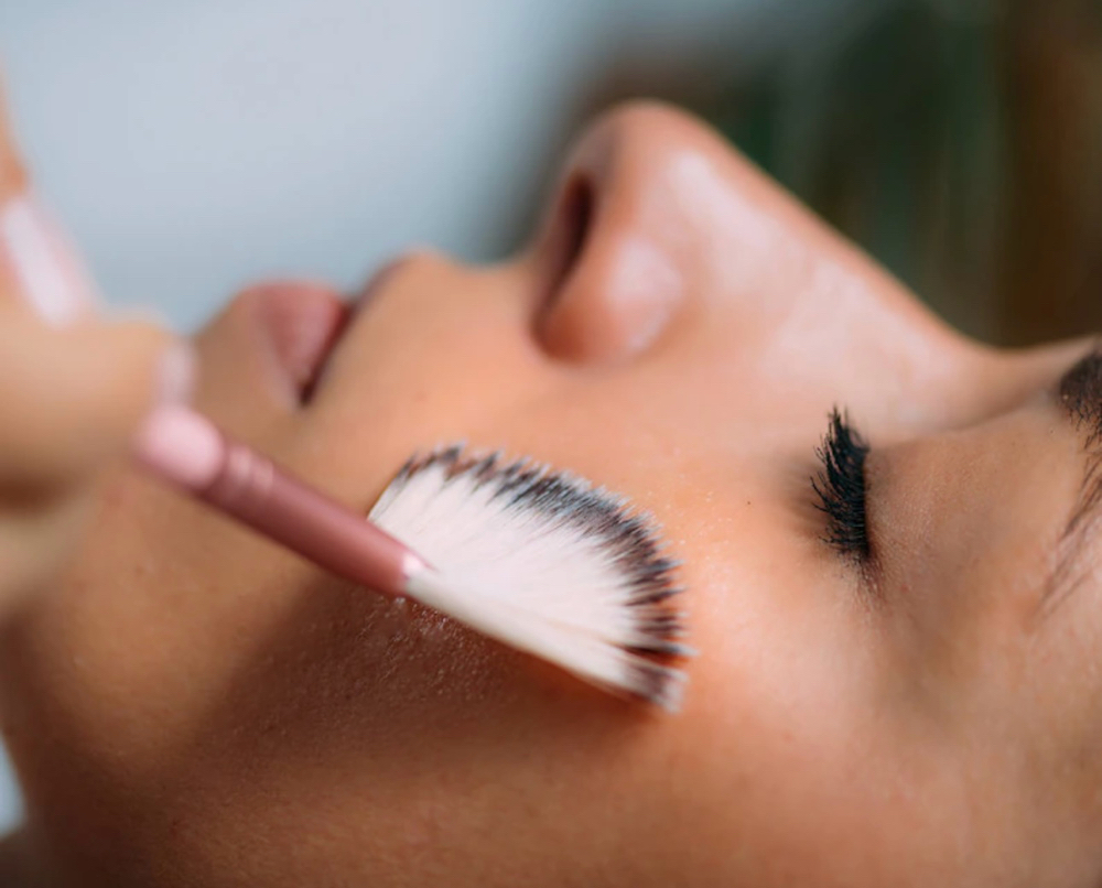 Chemical Peel