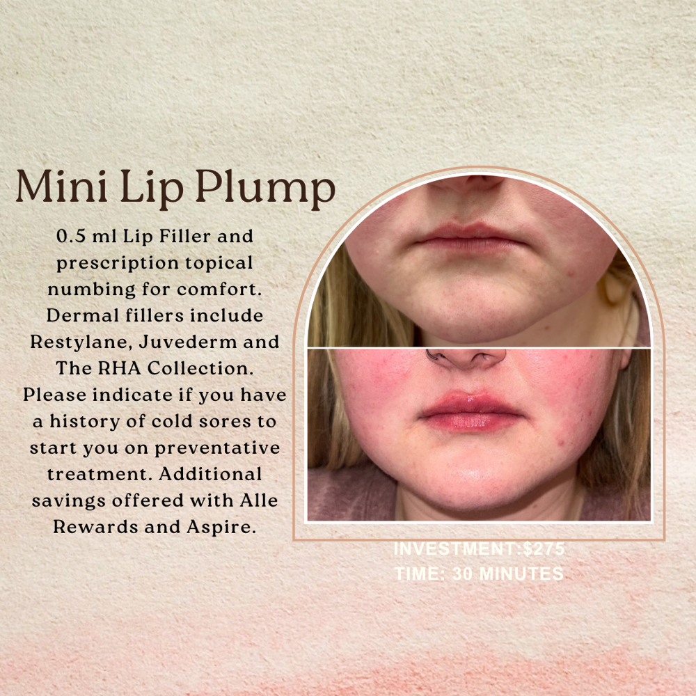 Mini Lip Plump
