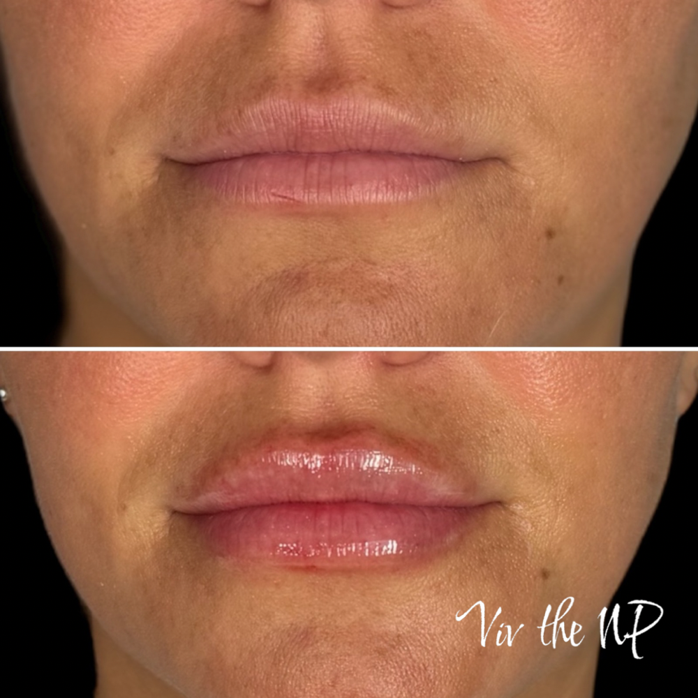 November Mini Lip $299