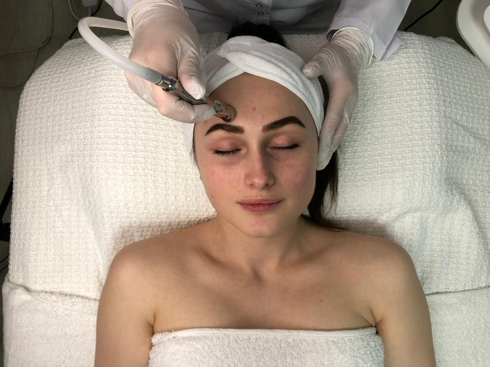 Microdermabrasion at Alina Buzinsky in West Dundee, IL