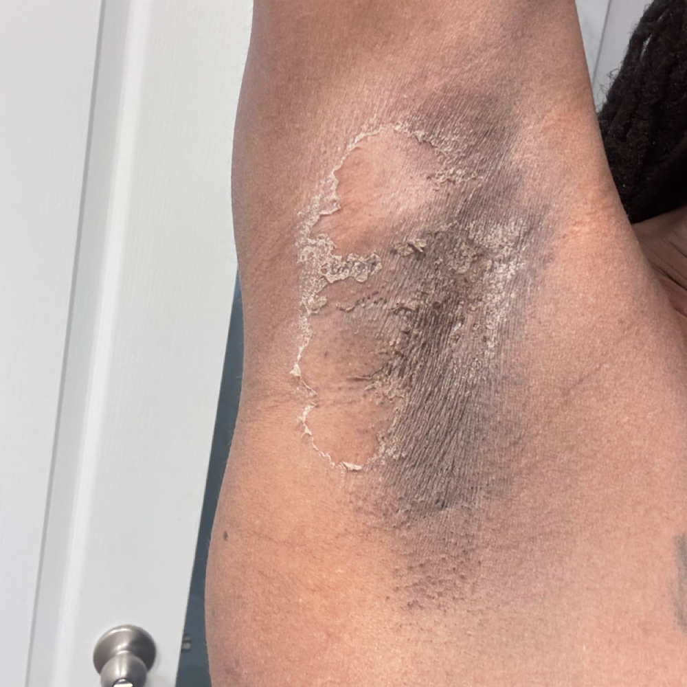 Intimate Skin Lighting at Aesthetics 189 in Hyattsville, MD