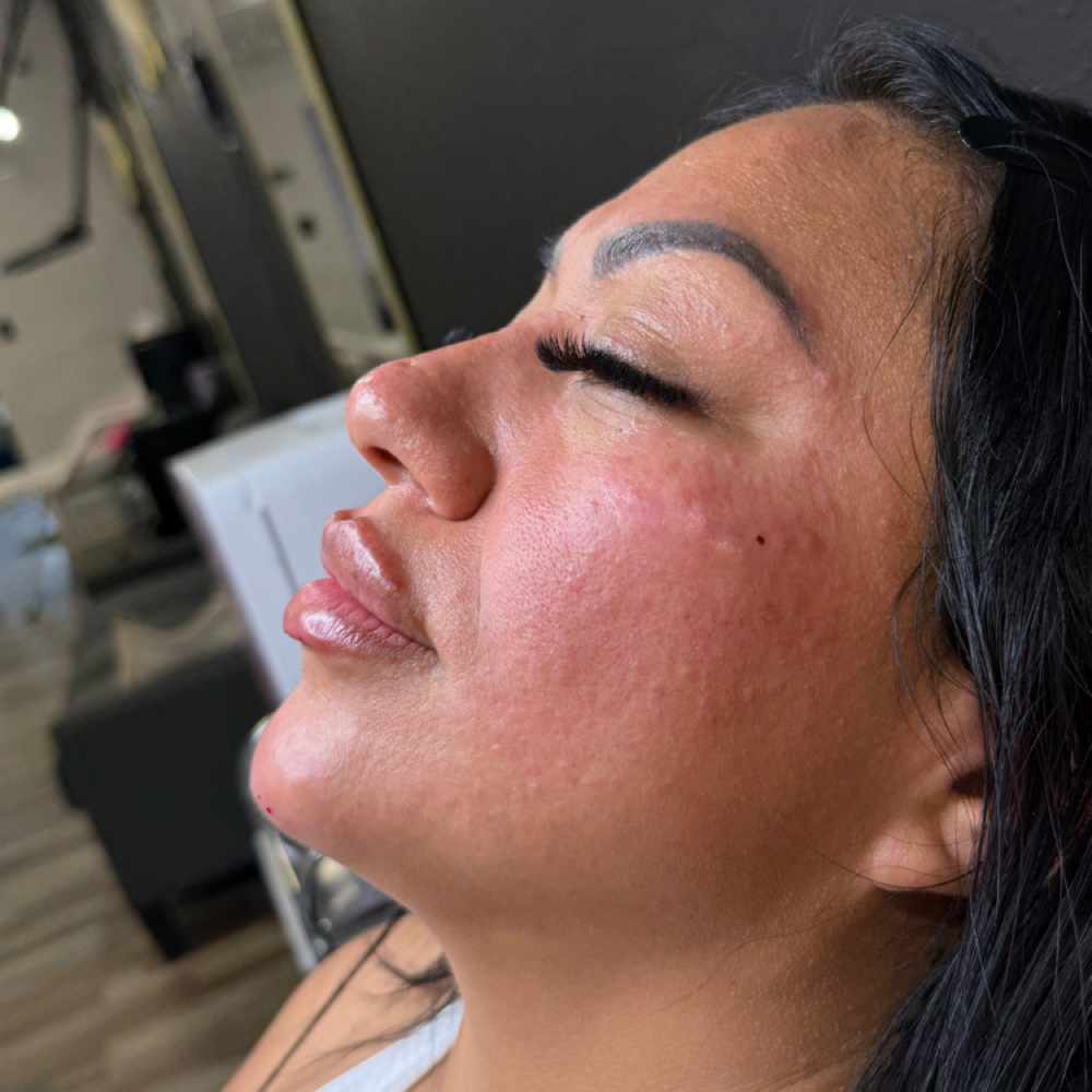 Mini Facial Balancing Special at Sinclairbeautystudio in San Antonio, TX
