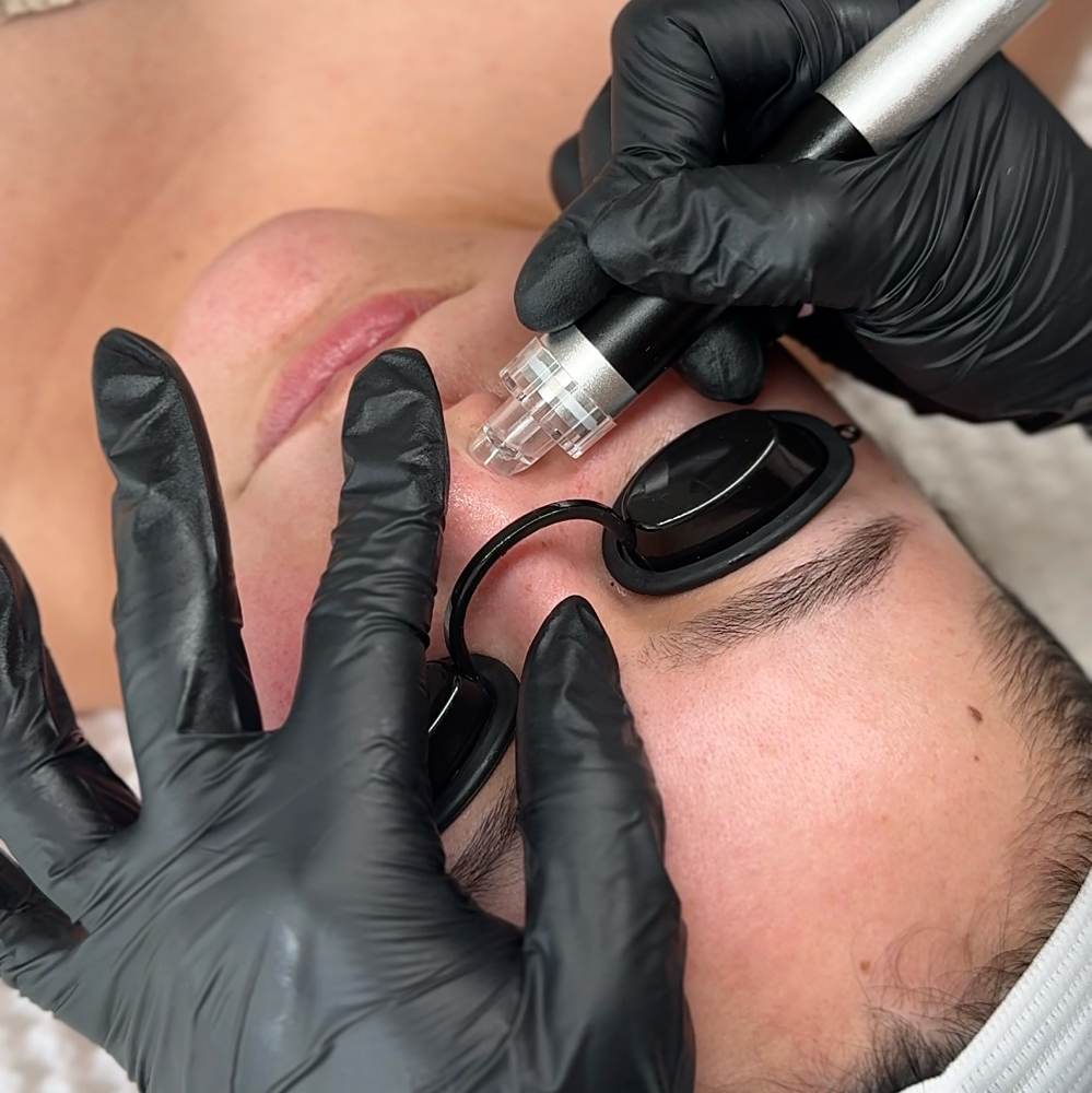 Hydro-Glow Facial