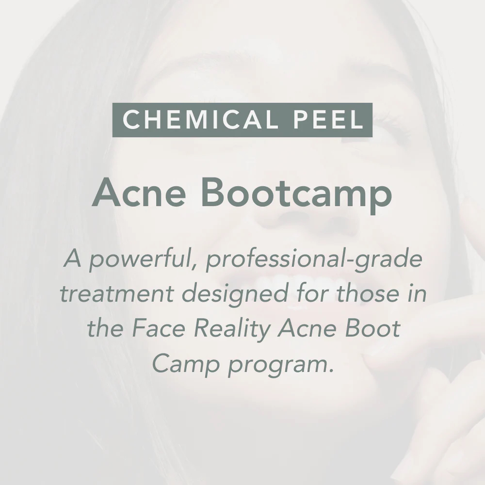 Acne Bootcamp Session at Hannah Daigle in Paradis, LA