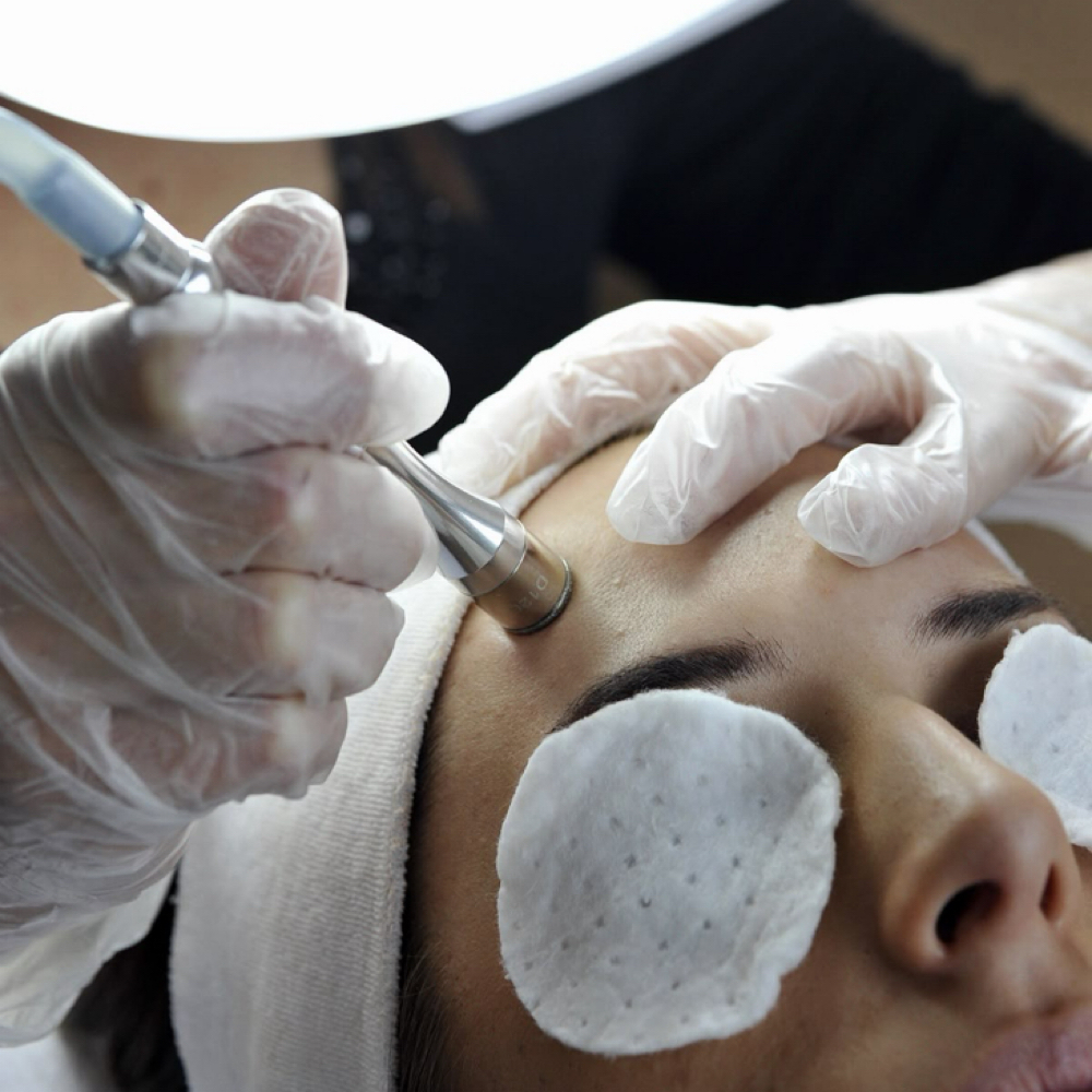 Microdermabrasion Facial at Glazed Beauty Collective in Silverhill, AL