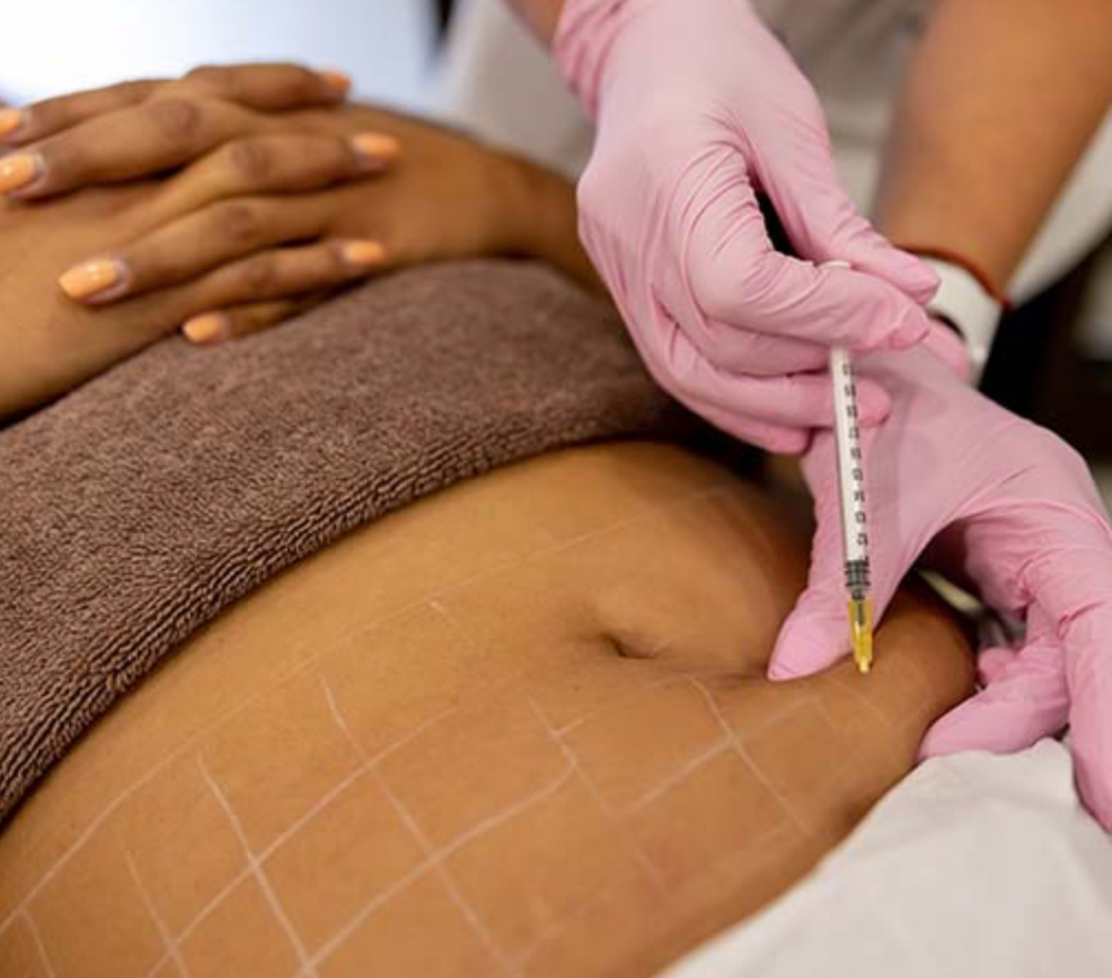 Lipo Shred Special- 3 Sessions