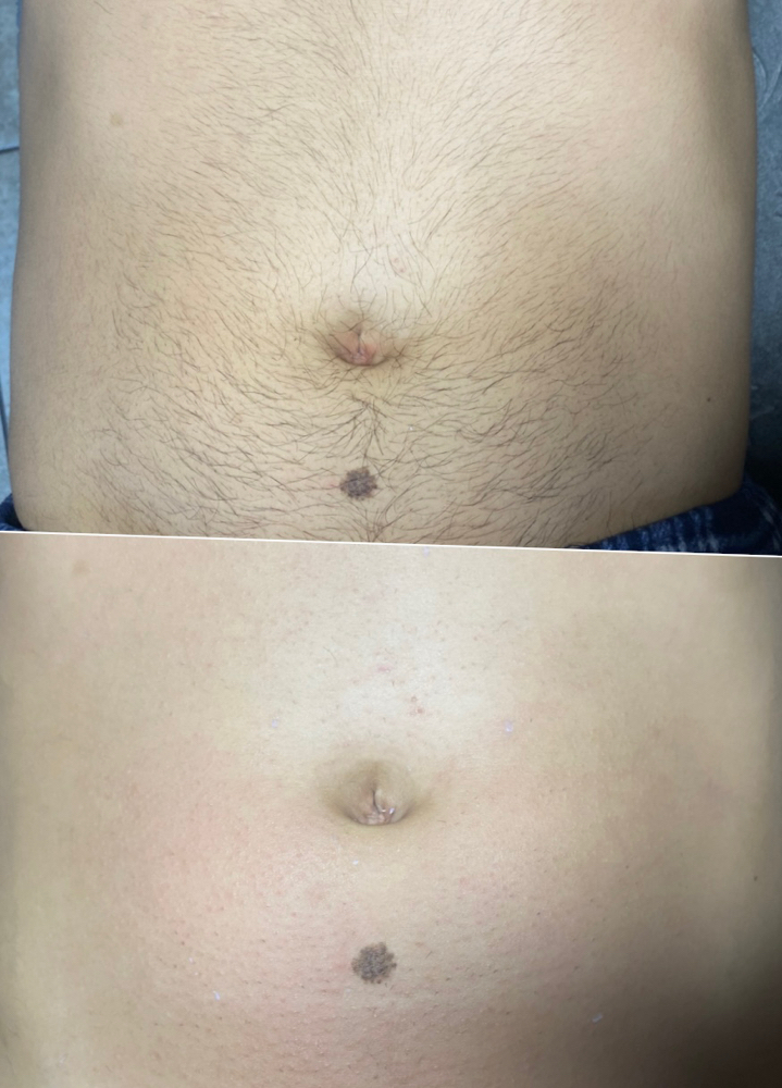Stomach Wax